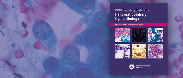 WHO Reporting System for Pancreaticobiliary Cytopathology