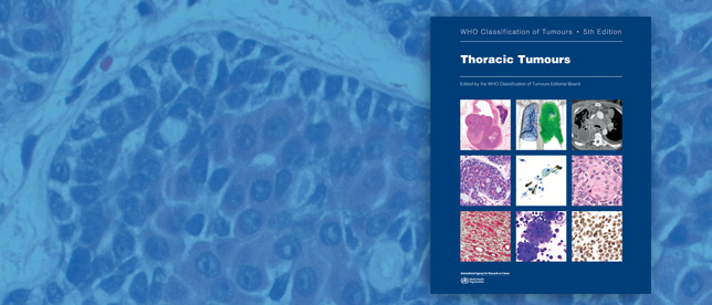Thoracic Tumours