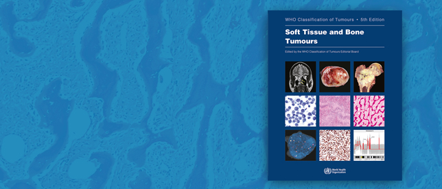 Soft Tissue and Bone Tumours