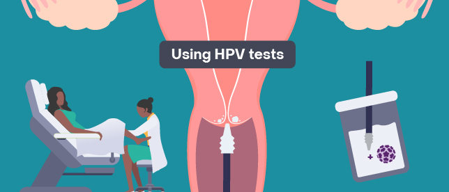 Using human papillomavirus (HPV) tests for cervical cancer screening and managing HPV-positive women