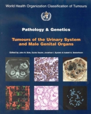 IARC Publications Website - WHO Classification of Tumours