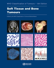 WHO Classification of Tumours of the Central Nervous System (WHO Health Organization Classification of Tumours) [ペーパーバック] International Agency for Research on Cancer、 Louis，David N.、 Ohgaki，Hiroko、 Wi