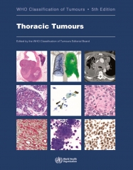 IARC Publications Website - WHO Classification of Tumours