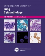 cytopathology lung cover.jpg