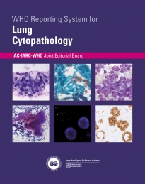 cytopathology lung cover.jpg