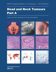 IARC Publications Website - WHO Classification of Tumours